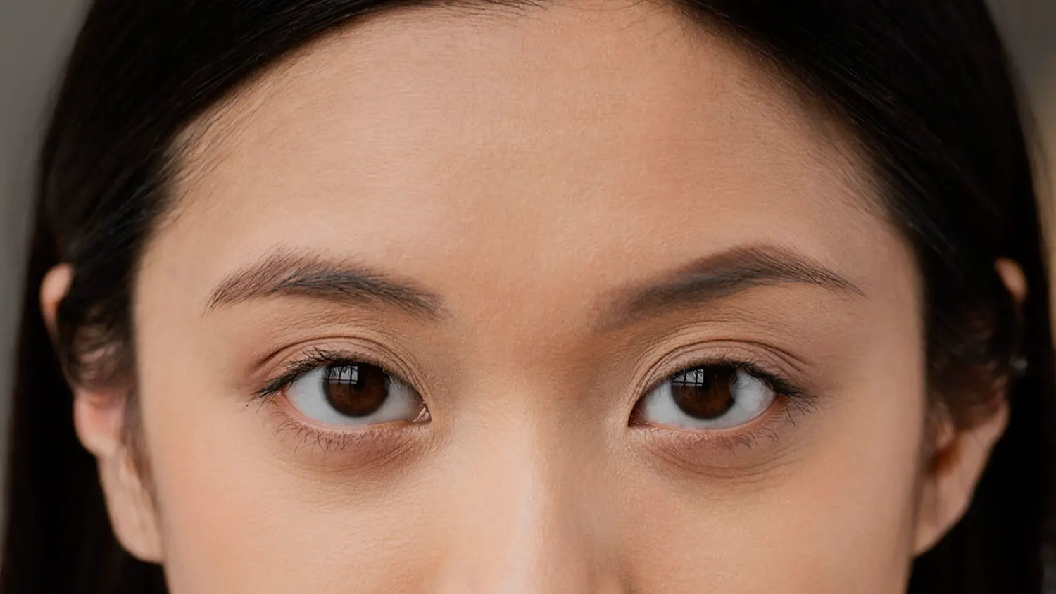 Under-eye dark circles linked to Kidney meridian imbalance in Traditional Chinese Medicine